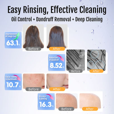 স্পা ও সৌন্দর্যের জন্য অতি-শ্রেষ্ঠ ন্যানো বুদবুদ জেনারেটর ∙ হাইড্রোজেন সমৃদ্ধ গভীর ত্বক পরিষ্কার এবং অক্সিজেন থেরাপি মেশিন